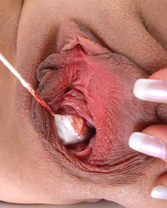 Pussy in a menstruation with blood