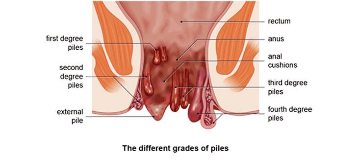 Gay buisness men porn thumbnails