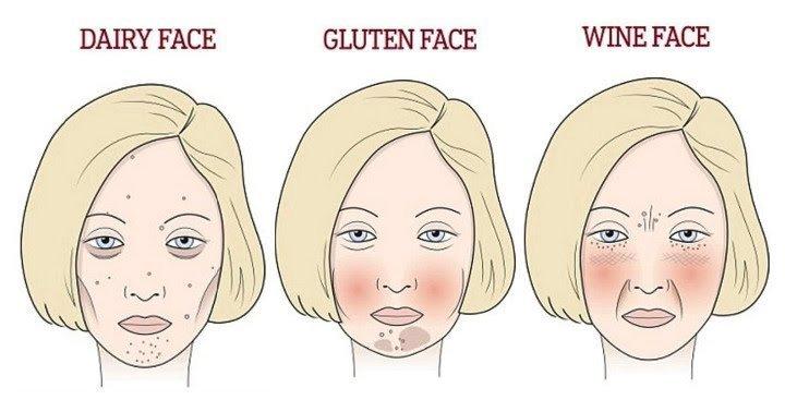 best of Indentation syndrome Facial